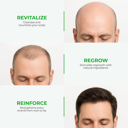 Green Wealth Neo Hair Lotion - Hair Treatment and Root Nutrients 120ml