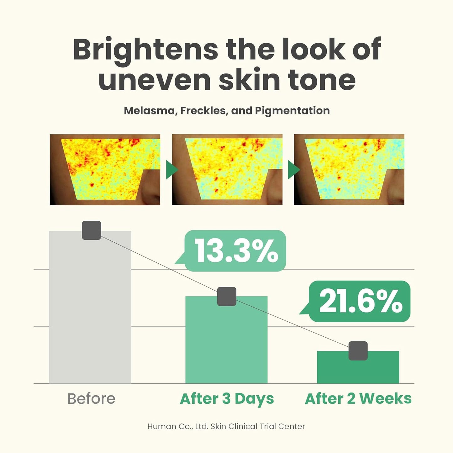 AXIS-Y Dark Spot Correcting Glow Serum - 5% Niacinamide Dark Spot Remover For Face - Vegan Korean Skin Care Niacinamide Serum