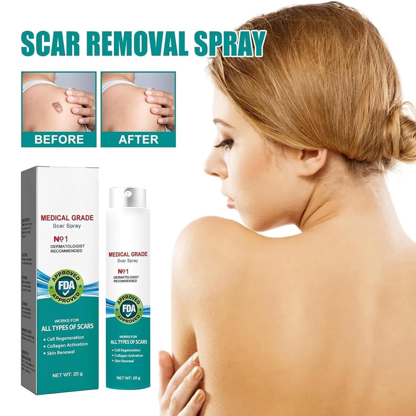 Medical Grade Scar Removal Spray