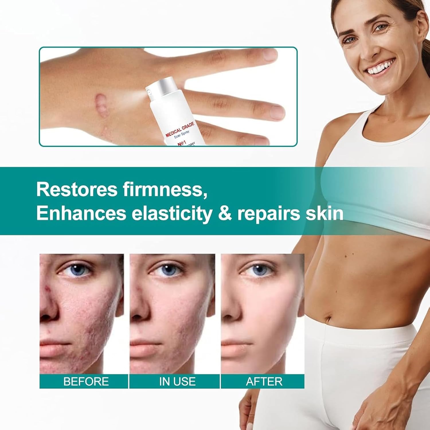 Medical Grade Scar Removal Spray