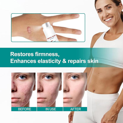 Medical Grade Scar Removal Spray