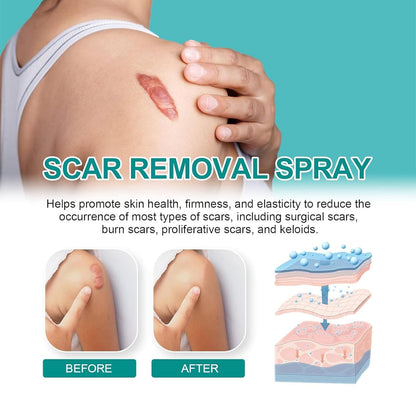 Medical Grade Scar Removal Spray