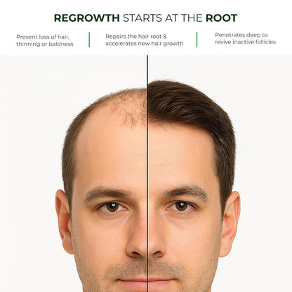 Green Wealth Neo Hair Lotion - Hair Treatment and Root Nutrients 120ml