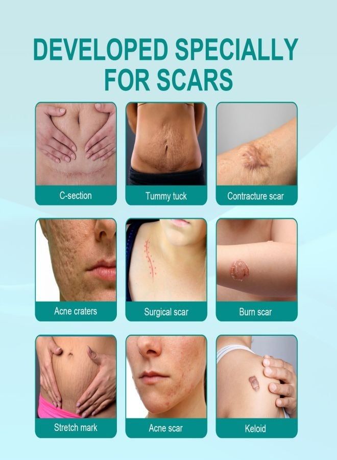 Medical Grade Scar Removal Spray