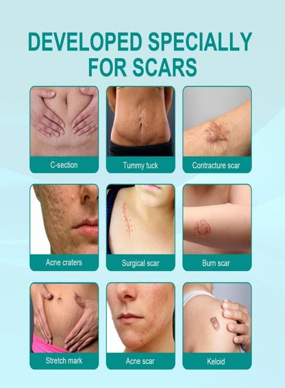 Medical Grade Scar Removal Spray