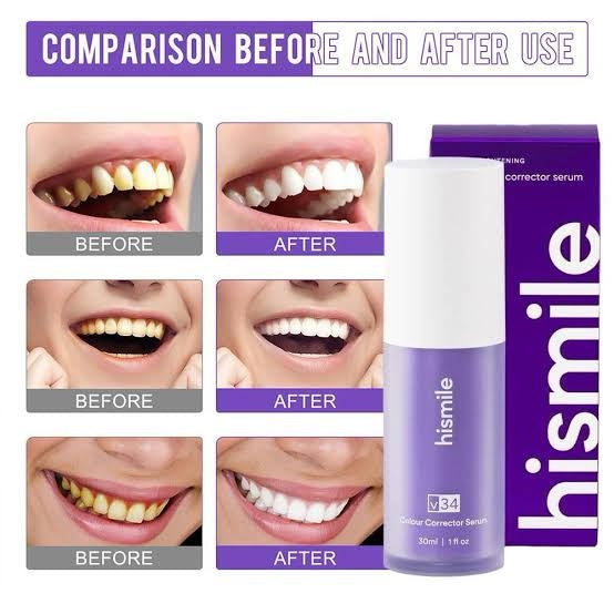 Libras Shop™ Hi Smile v34 Color Corrector, Purple Teeth Whitening, Tooth Stain Removal, Teeth Whitening Booster, Purple Toothpaste