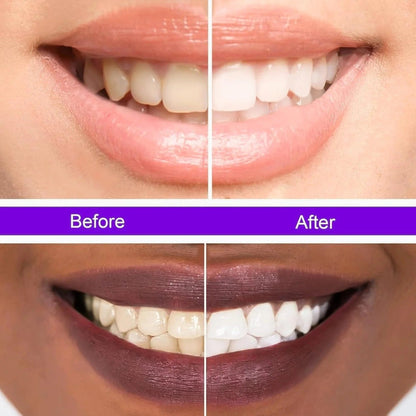 Libras Shop™ Hi Smile v34 Color Corrector, Purple Teeth Whitening, Tooth Stain Removal, Teeth Whitening Booster, Purple Toothpaste