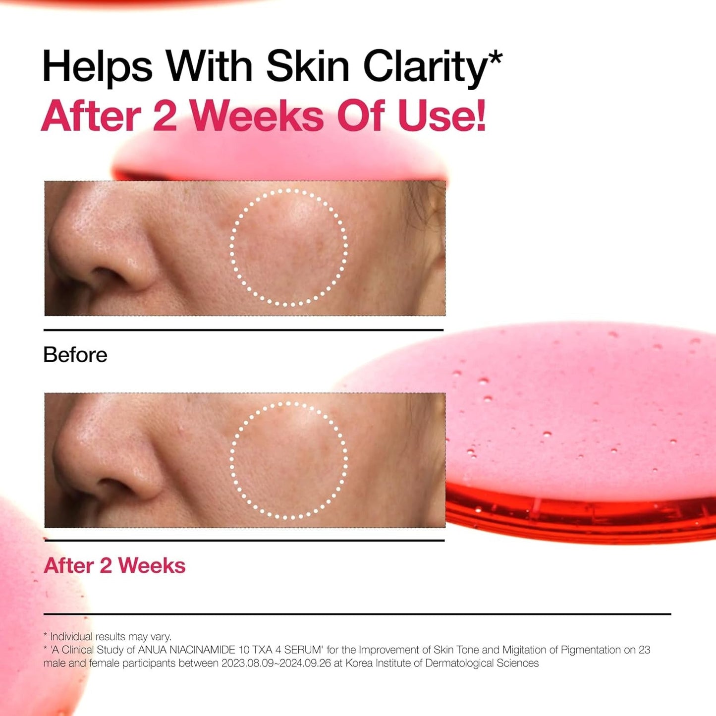 Anua Niacinamide 10% + TXA 4% Serum – Brightening Facial Serum with Hyaluronic Acid, Tranexamic Acid & Vitamin B12 for Radiant Glass Skin 30ml